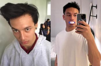 Jefri Nichol Bongkar Potret Zaman SMK, Jambul Membahana Bikin Salfok