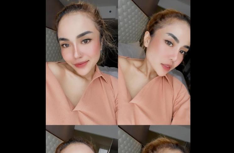 Potret Terbaru Medina Zein (Instagram/@medinazein92)