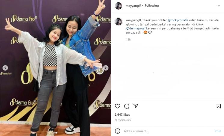Mayang dan Chika perawatan wajah habiskan Rp 90 juta. (Instagram/mayyanglf)