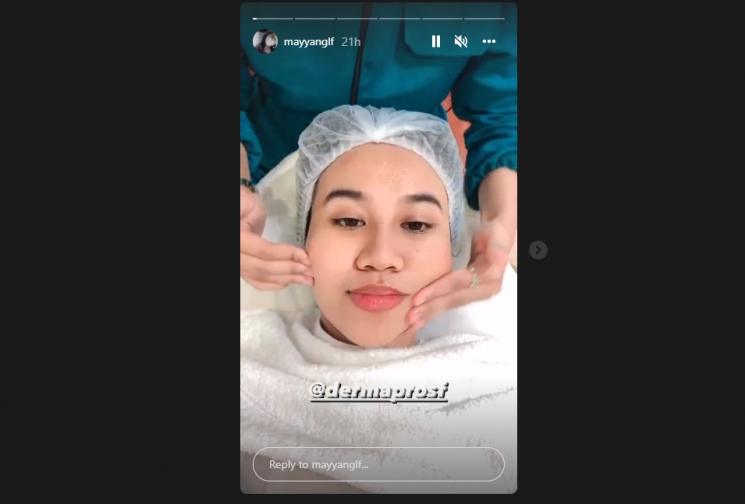 Mayang dan Chika perawatan wajah habiskan Rp 90 juta. (Instagram/mayyanglf)