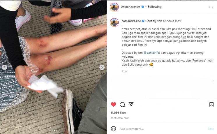 Cassandra Lee kecelakaan saat syuting film. (Instagram/cassandraslee)