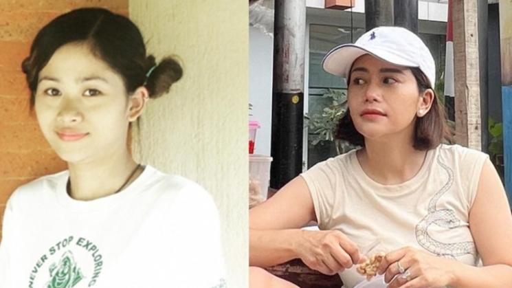 Potret Artis Setelah Operasi Plastik (Instagram/@farida.nurhan)