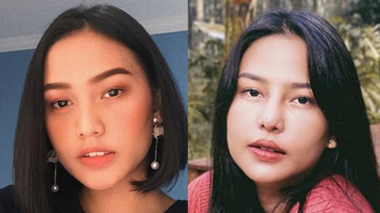 Potret Artis Setelah Operasi Plastik (Instagram/@daraarafah)