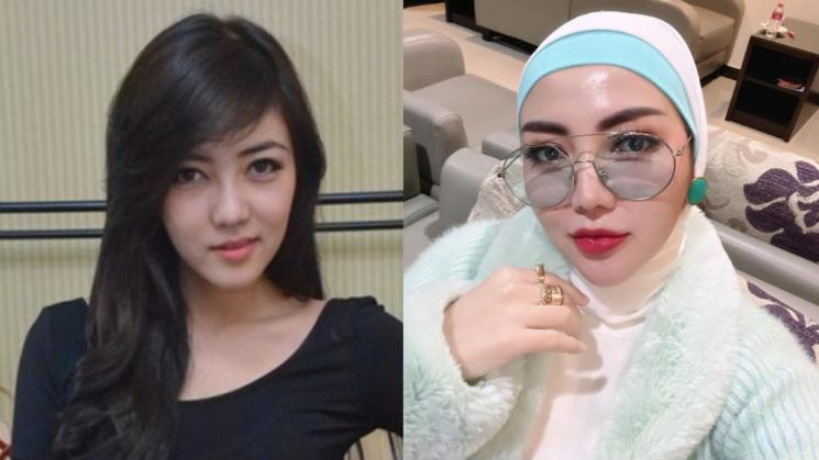 Potret Artis Setelah Operasi Plastik (Instagram/@bellashofie_rigan)