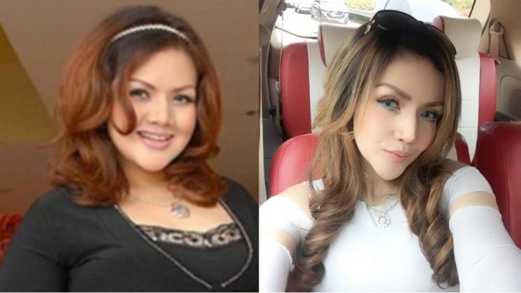 Potret Artis Setelah Operasi Plastik (Instagram/@barbiekumalasari)