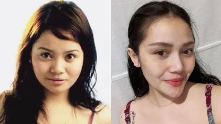 Potret Artis Setelah Operasi Plastik (Instagram/@mysamawar)