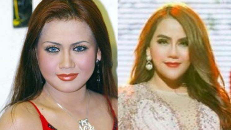 Potret Artis Setelah Operasi Plastik (Instagram/@nitatalia.real)