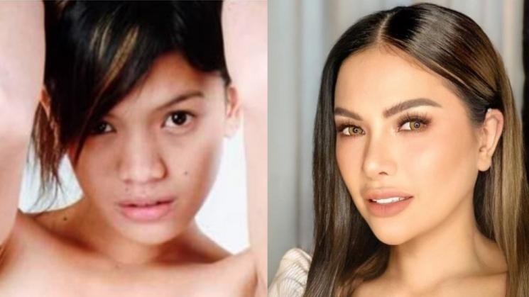 Potret Artis Setelah Operasi Plastik (Instagram/@nikitamirzanimawardi_172)