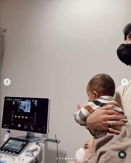 Kronologi Dinda Hauw Keguguran Anak Kembar (Instagram/dindahw)