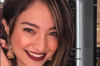 9 Potret Transformasi Rambut Marshanda, Gunakan Warna yang Tak Biasa