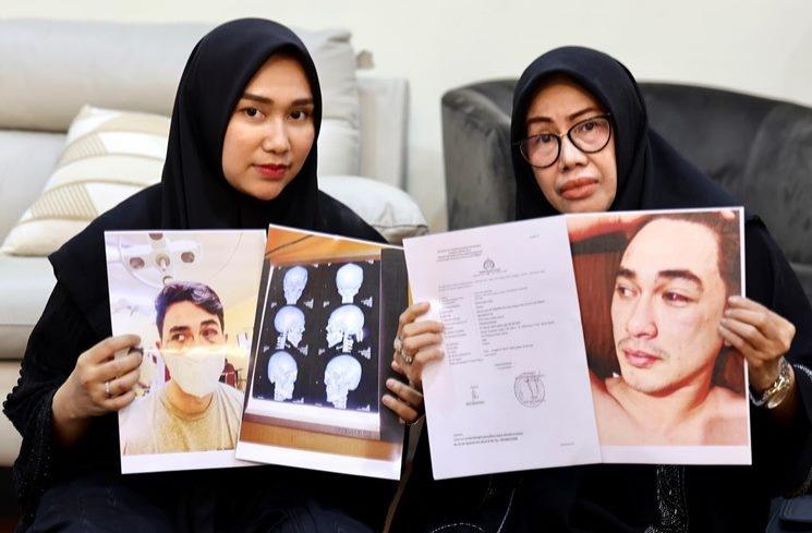 Istri Putra Siregar bongkar fakta soal Rico Valentino. (Instagram/@septiasiregar17)