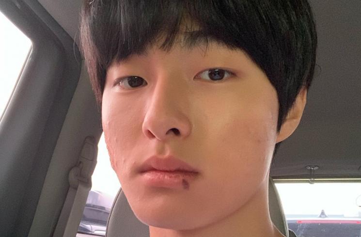 Drama Yoon Chan Young (Instagram/@yooncy1)