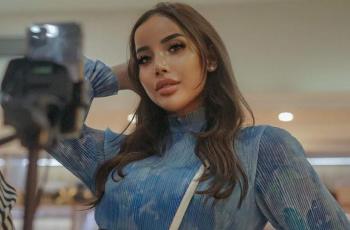 8 Penampilan Terbaru Millen Cyrus, Wajahnya Dibilang Beda