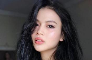 4 Potret Dinda Syarif Sebelum dan Sesudah Operasi Jakun, Makin Cantik Paripurna