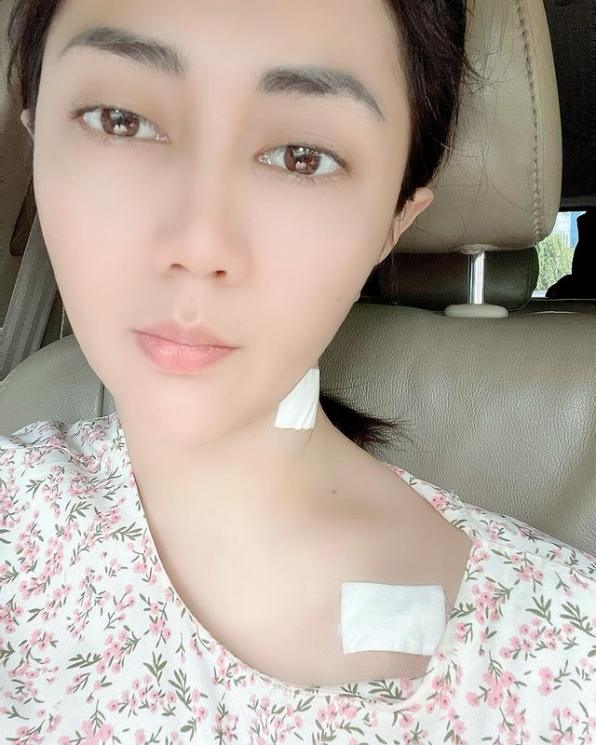 Kisah Aida Saskia Lawan Kanker Payudara. (Instagram/@aidasaskia.new)