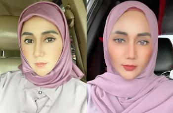 7 Kisah Aida Saskia Lawan Kanker Payudara, Operasi 4 Kali sampai Harus Belajar Berjalan