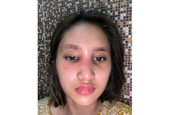 Transformasi Permesta Dhyaz Anak Farida Nurhan (instagram/@permestadhyaz)