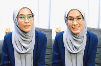 Tubuh Kelewat Kurus sampai Bikin Cemas, Alyssa Soebandono Akhirnya Buat Pengakuan