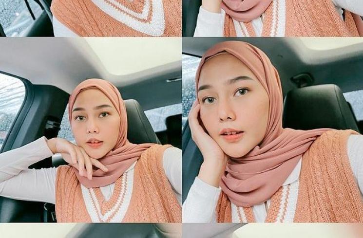 Potret Terbaru Dara Arafah. (Instagram/daraarafah)