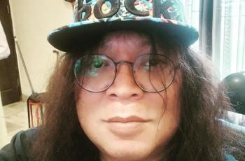 Doddy Katamsi Ungkap Kondisinya usai Alami Pembengkakan dan Klep Jantung Bocor