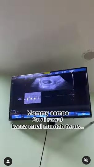 Momen Istri Ikbal fauzi Ikatan Cinta Melahirkan. (Instagram/ikbalfauzi_)