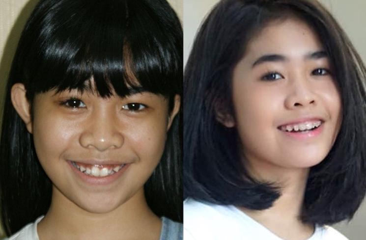 Transformasi Alifa Lubis (Instagram/@alifalubis)