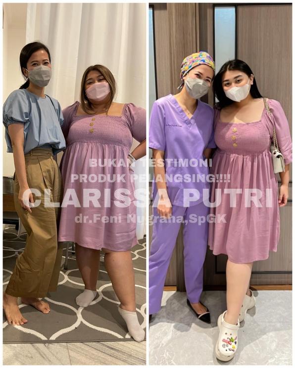 Transformasi Clarissa Putri. (Instagram/clarissaputri_)