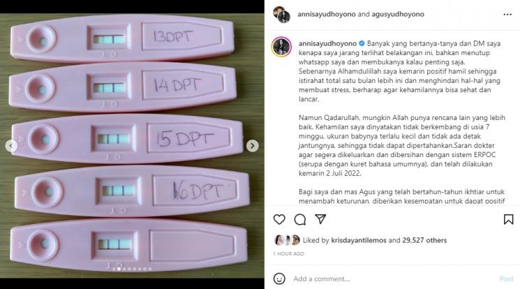 Annisa Pohan keguguran. (Instagram/annisayudhoyono)