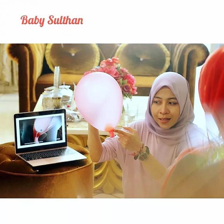 Potret Roro Fitria Jalani Persiapan Persalinan(Instagram/@roro.fitria1989)