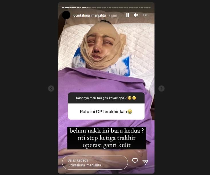 Lucinta Luna bakal operasi ganti kulit? (Instagram/@lucintaluna_manjalita)
