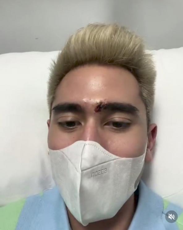 Momen Verrel Bramasta Dijahit Usai Terjatuh(Instagram@ bramstavrl)