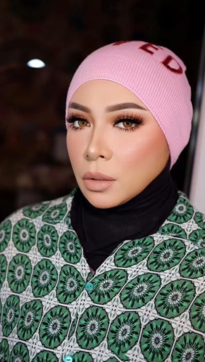 Potret Melly Goeslaw setelah Operasi Bariatrik (instagram/@melly_goeslaw)