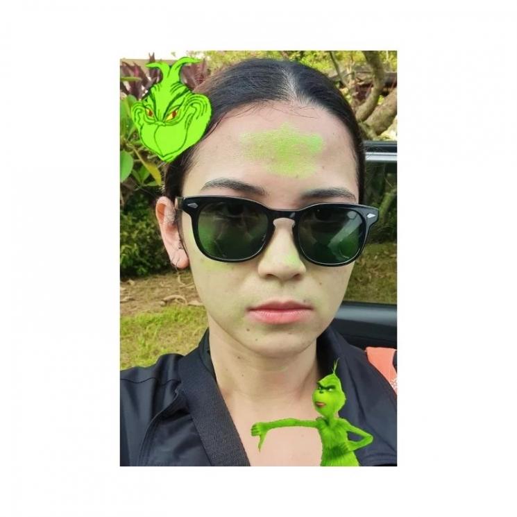Potret terbaru Dinda Kanya Dewi. (Instagram/dindakanyaa)
