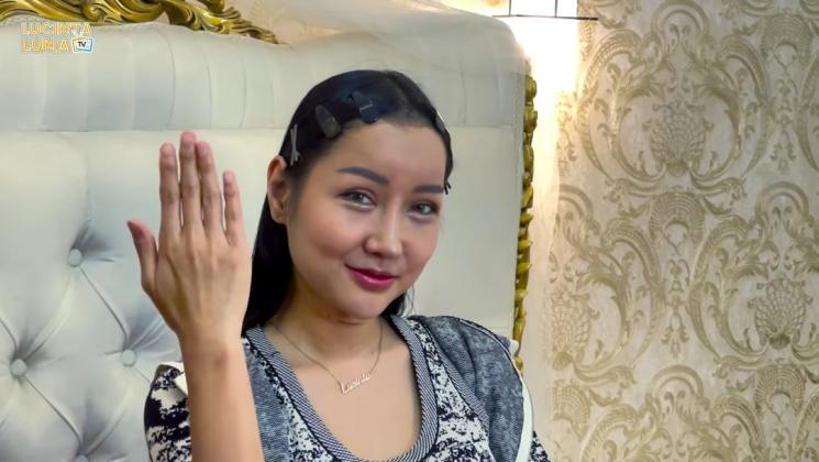 Momen Lucinta Luna Pamer Wajah Usai Operasi (YouTube/Lucinta Luna TV)
