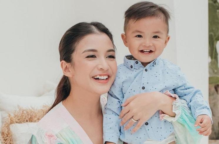 Potret Chelsea Olivia dengan gigi gingsulnya (Instagram/@chelseaoliviaa)