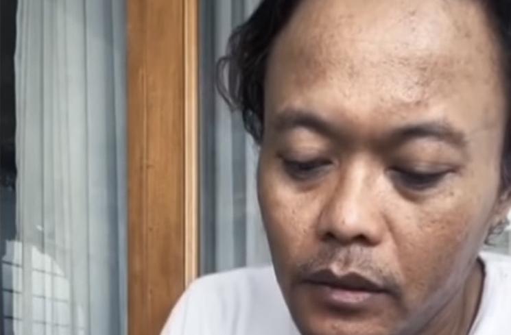 Potret Terkini Sule Usai Cerai (instagram/@ferdinan_sule)