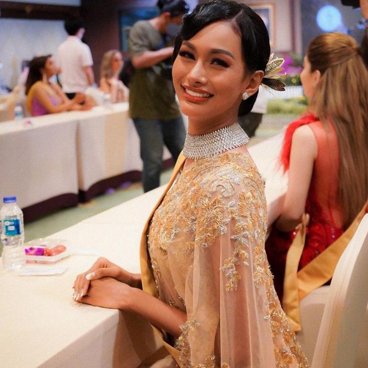 Potret Aurra Kharishma Sebelum dan Sesudah Oplas (Instagram/aurrakharishma)
