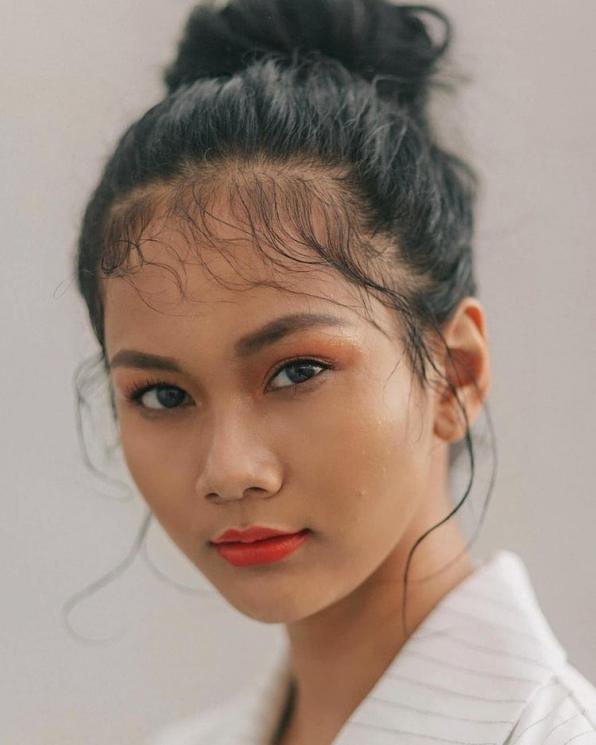Potret Aurra Kharishma Sebelum dan Sesudah Oplas (Instagram/aurrakharishma)