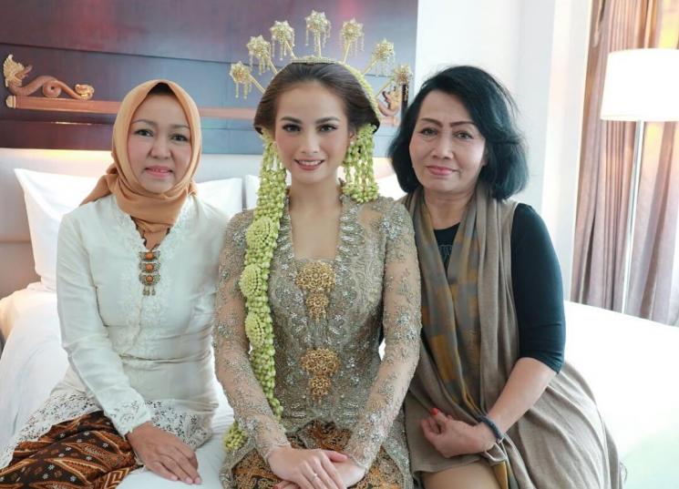 Transformasi Acha Septriasa(Instagram/@septriasaacha)