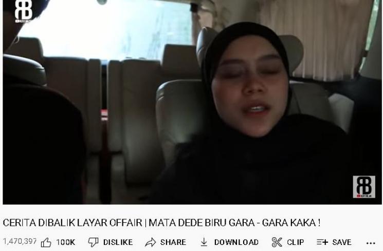 Penjelasan mata Lesti Kejora Lebam (youtube/Rizky Billar)