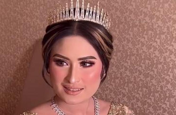 Potret Syukuran Khitanan Anak Adly Fairuz. (Instagram/angbeenrishi)