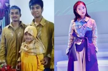 11 Potret Transformasi Fuji yang Genap Berusia 20 Tahun, Tulis Pesan Haru Kenang Sang Kakak