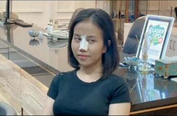 Dituding Abaikan Ibadah gegara Bekas Operasi Hidung, Mayang Beri Jawaban Menohok