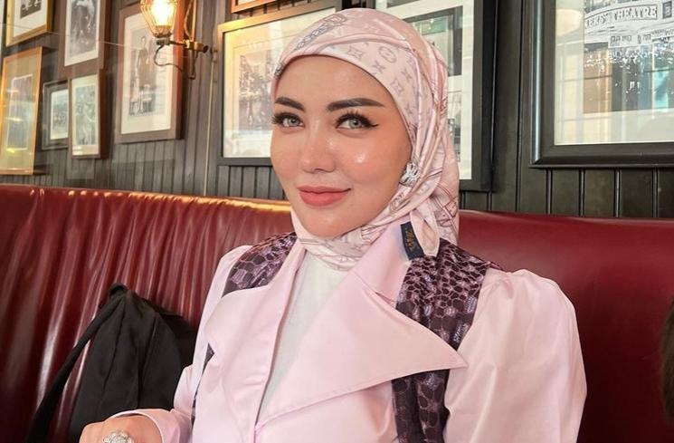 Artis Blak-blakan Ngaku Operasi Hidung (instagram/@bellashofie_rigan)