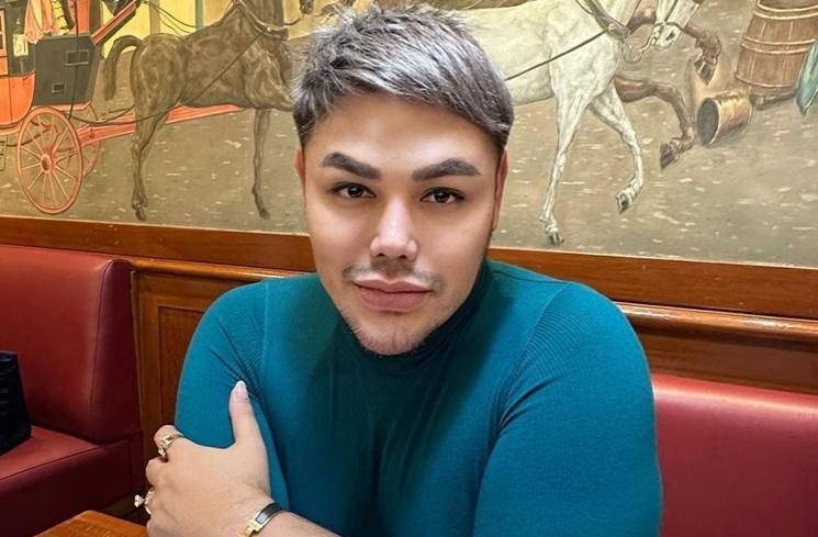 Artis Blak-blakan Ngaku Operasi Hidung (instagram/@ivan_gunawan)