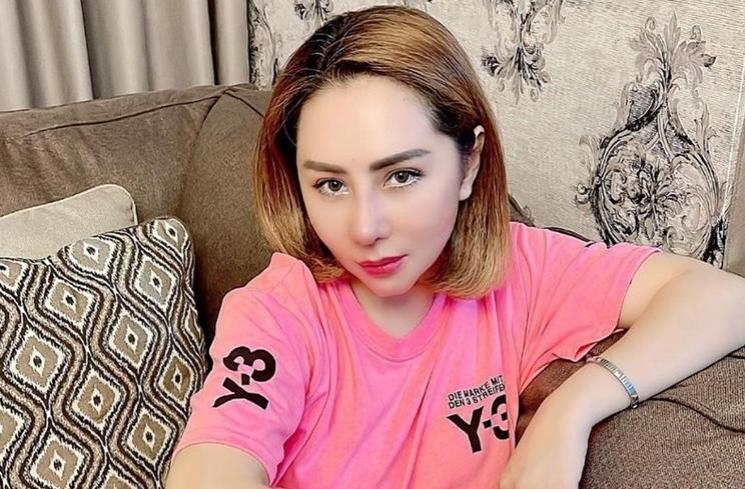 Artis Blak-blakan Ngaku Operasi Hidung (instagram/@femmypermatasari)