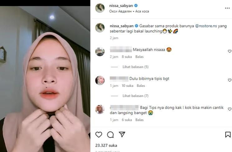 Nissa Sabyan Digosipin Gara-gara Bibir Makin Tebal. (Instagram/nissa_sabyan)