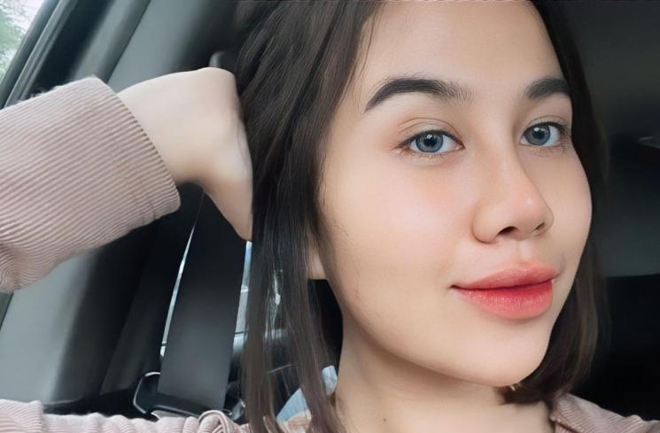 Momen Mayang Buka Perban Setelah Operasi Hidung (Instagram/@ketawaituberkahttv)