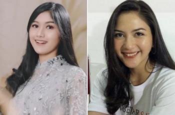 Foto Lama Erina Gudono Pakai Behel Disorot, Mirip Banget sama Jessica Mila