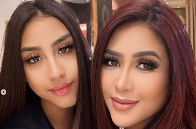 Potret terkini Khayra anak Gunawan. (Instagram/gunawan_sudrajat_real)